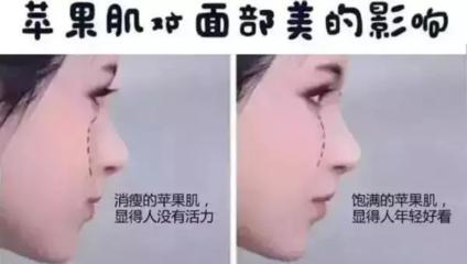 iphone心形软件